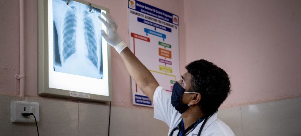 Funding cuts jeopardise global fight against tuberculosis, WHO warns